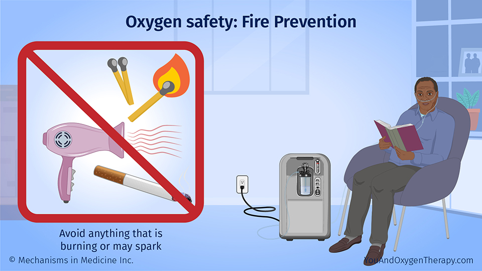 Oxygen safety: Fire Prevention