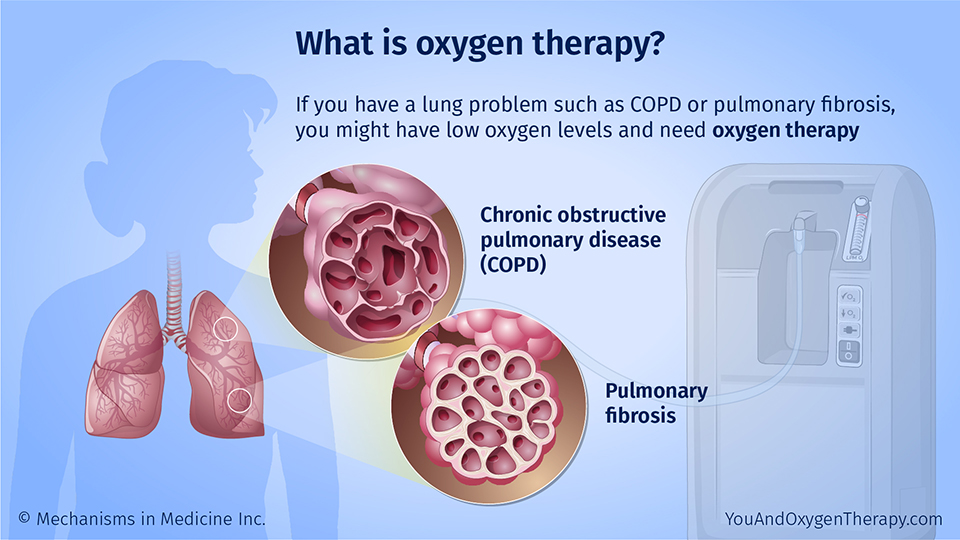 What is oxygen therapy?